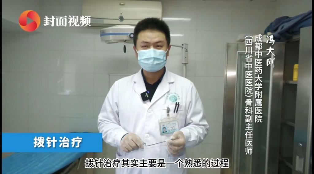 特色療灋(fa)：拔針治療